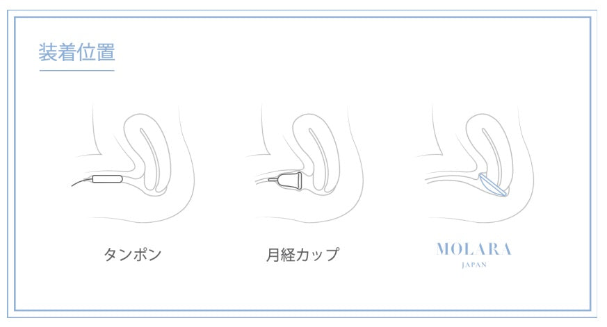 月経ディスク「MOLARA（モララ）」は子宮口の奥に装着する生理用品